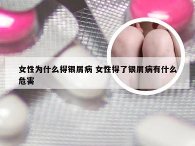 女性为什么得银屑病 女性得了银屑病有什么危害