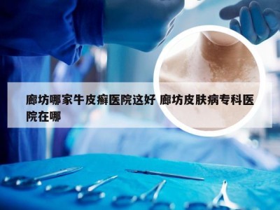 廊坊哪家牛皮癣医院这好 廊坊皮肤病专科医院在哪