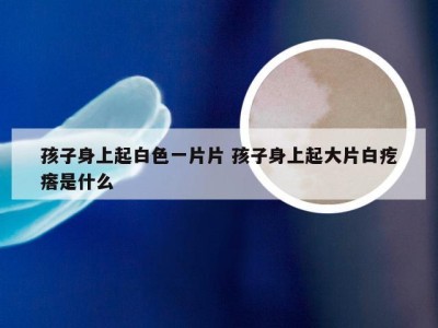 孩子身上起白色一片片 孩子身上起大片白疙瘩是什么