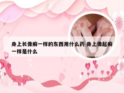 身上长像癣一样的东西用什么药 身上像起癣一样是什么