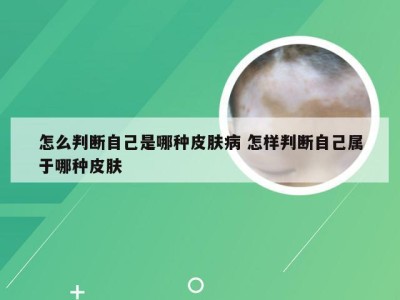 怎么判断自己是哪种皮肤病 怎样判断自己属于哪种皮肤