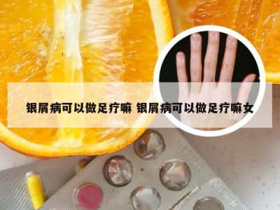 银屑病可以做足疗嘛 银屑病可以做足疗嘛女