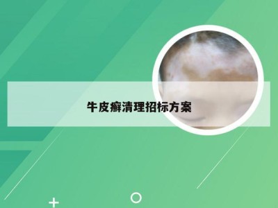 牛皮癣清理招标方案