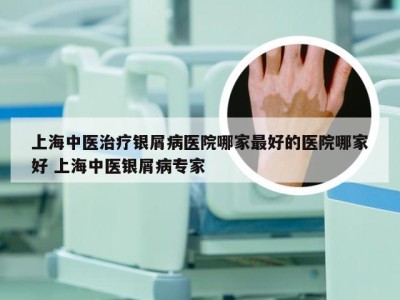 上海中医治疗银屑病医院哪家最好的医院哪家好 上海中医银屑病专家