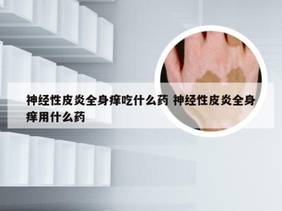 神经性皮炎全身痒吃什么药 神经性皮炎全身痒用什么药