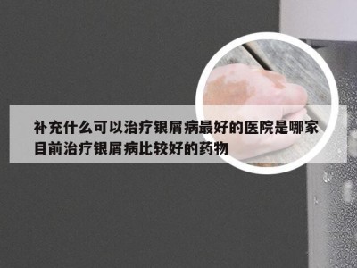 补充什么可以治疗银屑病最好的医院是哪家 目前治疗银屑病比较好的药物