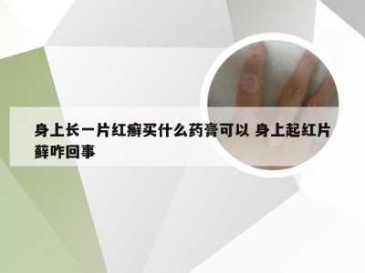 身上长一片红癣买什么药膏可以 身上起红片藓咋回事