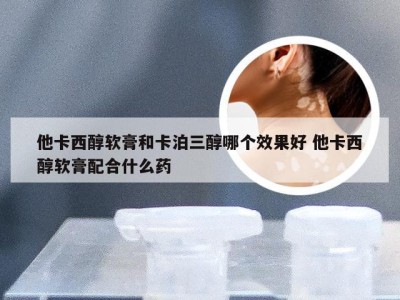 他卡西醇软膏和卡泊三醇哪个效果好 他卡西醇软膏配合什么药