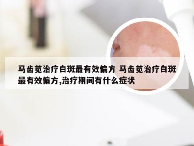 马齿苋治疗白斑最有效偏方 马齿苋治疗白斑最有效偏方,治疗期间有什么症状