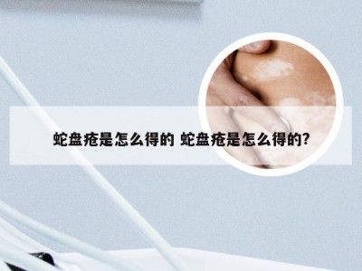 蛇盘疮是怎么得的 蛇盘疮是怎么得的?