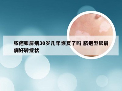 脓疱银屑病30岁几年恢复了吗 脓疱型银屑病好转症状