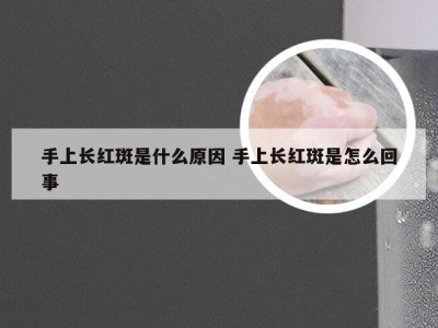 手上长红斑是什么原因 手上长红斑是怎么回事