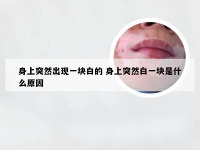 身上突然出现一块白的 身上突然白一块是什么原因