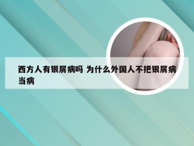 西方人有银屑病吗 为什么外国人不把银屑病当病