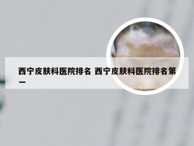 西宁皮肤科医院排名 西宁皮肤科医院排名第一