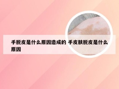 手脱皮是什么原因造成的 手皮肤脱皮是什么原因