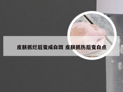 皮肤抓烂后变成白斑 皮肤抓伤后变白点