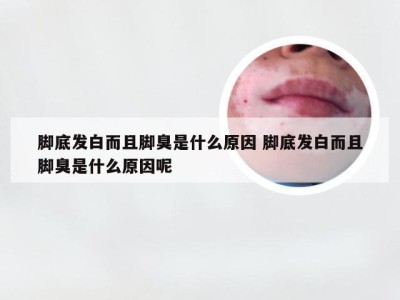 脚底发白而且脚臭是什么原因 脚底发白而且脚臭是什么原因呢