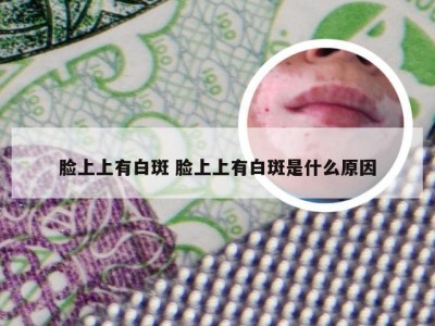 脸上上有白斑 脸上上有白斑是什么原因