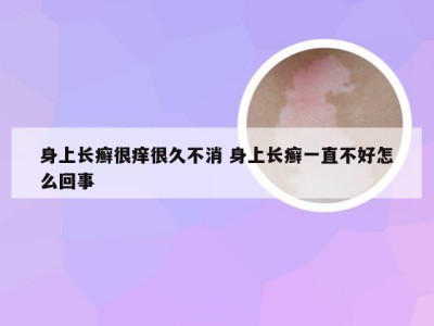 身上长癣很痒很久不消 身上长癣一直不好怎么回事