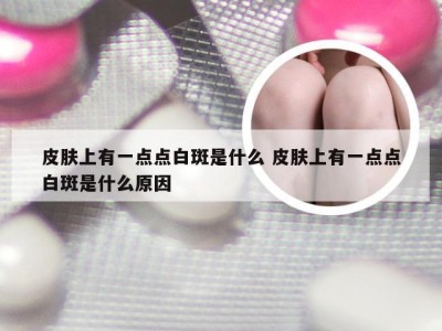 皮肤上有一点点白斑是什么 皮肤上有一点点白斑是什么原因