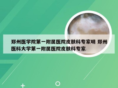 郑州医学院第一附属医院皮肤科专家明 郑州医科大学第一附属医院皮肤科专家