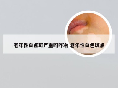 老年性白点斑严重吗咋冶 老年性白色斑点