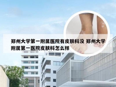 郑州大学第一附属医院有皮肤科没 郑州大学附属第一医院皮肤科怎么样
