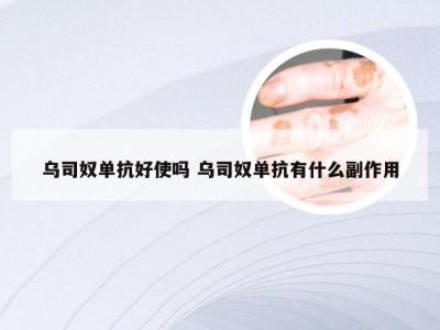 乌司奴单抗好使吗 乌司奴单抗有什么副作用