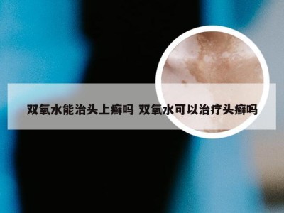 双氧水能治头上癣吗 双氧水可以治疗头癣吗