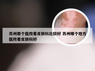 苏州那个医院看皮肤科比较好 苏州哪个地方医院看皮肤科好