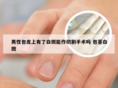 男性包皮上有了白斑能作切割手术吗 包茎白斑