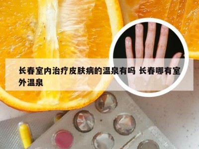 长春室内治疗皮肤病的温泉有吗 长春哪有室外温泉