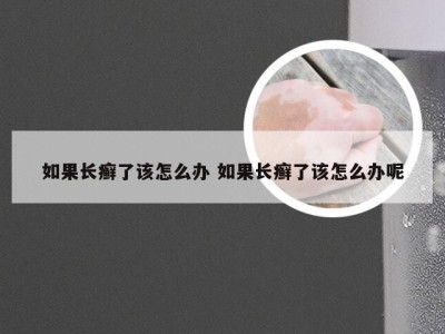 如果长癣了该怎么办 如果长癣了该怎么办呢