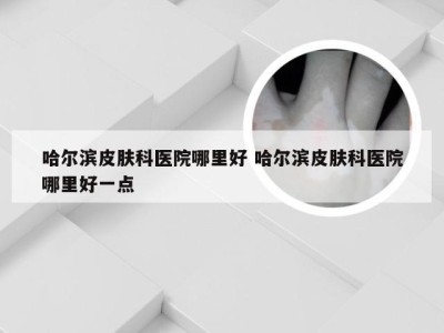 哈尔滨皮肤科医院哪里好 哈尔滨皮肤科医院哪里好一点