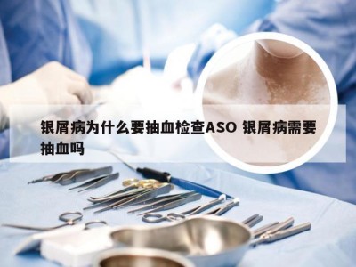 银屑病为什么要抽血检查ASO 银屑病需要抽血吗