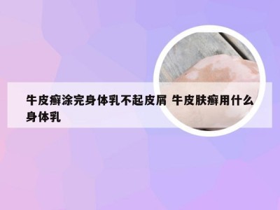 牛皮癣涂完身体乳不起皮屑 牛皮肤癣用什么身体乳