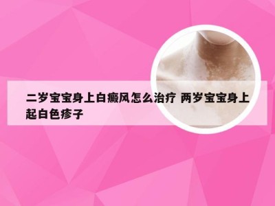 二岁宝宝身上白癜风怎么治疗 两岁宝宝身上起白色疹子