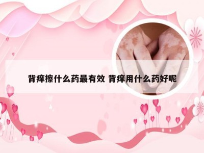 背痒擦什么药最有效 背痒用什么药好呢