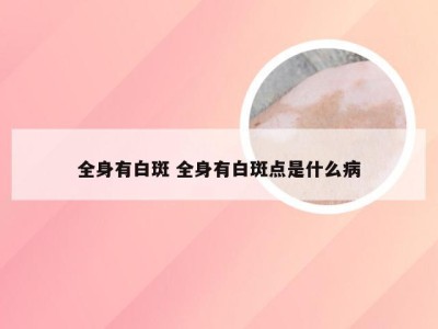 全身有白斑 全身有白斑点是什么病