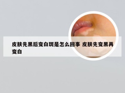 皮肤先黑后变白斑是怎么回事 皮肤先变黑再变白