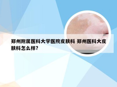 郑州附属医科大学医院皮肤科 郑州医科大皮肤科怎么样?