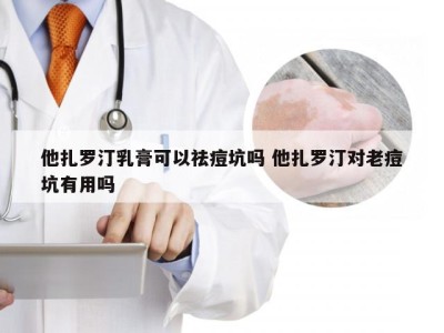 他扎罗汀乳膏可以祛痘坑吗 他扎罗汀对老痘坑有用吗