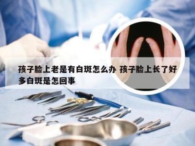 孩子脸上老是有白斑怎么办 孩子脸上长了好多白斑是怎回事