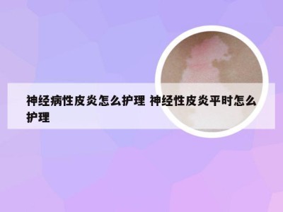 神经病性皮炎怎么护理 神经性皮炎平时怎么护理