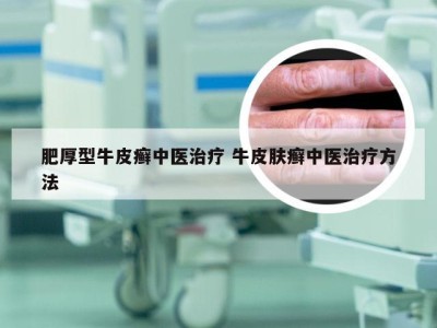 肥厚型牛皮癣中医治疗 牛皮肤癣中医治疗方法