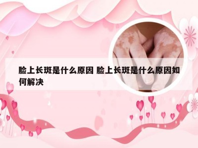 脸上长斑是什么原因 脸上长斑是什么原因如何解决