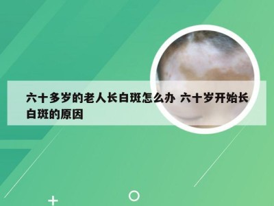 六十多岁的老人长白斑怎么办 六十岁开始长白斑的原因