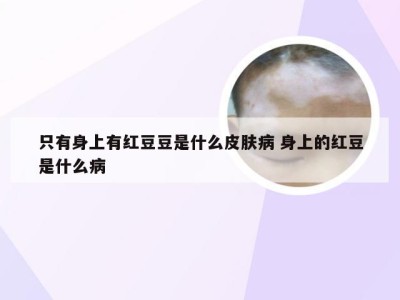 只有身上有红豆豆是什么皮肤病 身上的红豆是什么病