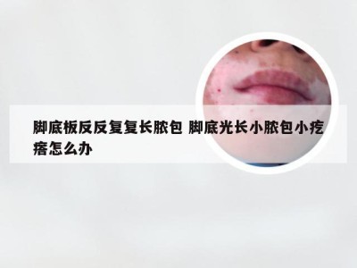 脚底板反反复复长脓包 脚底光长小脓包小疙瘩怎么办